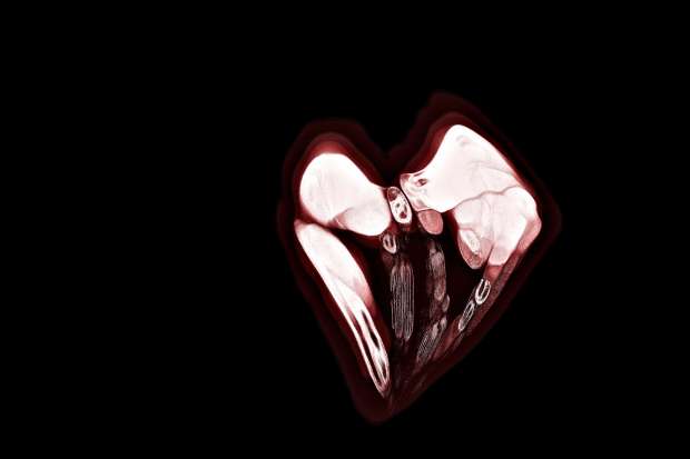 heartanatomyclearvibrantlq